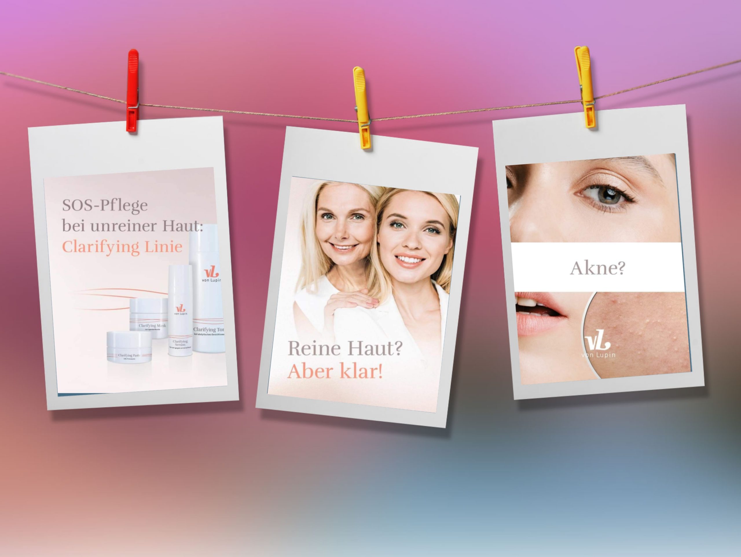 Featured image for “Pickel, Mitesser, Unterlagerungen und Akne: Was kann helfen?”