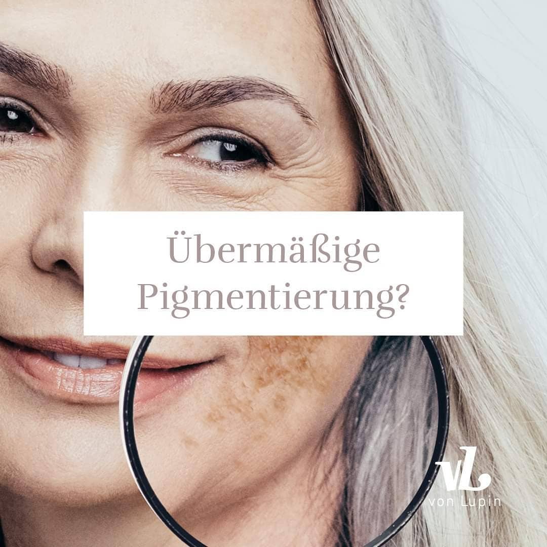 Featured image for “Pigmentstörungen? Was kann ich tun?”