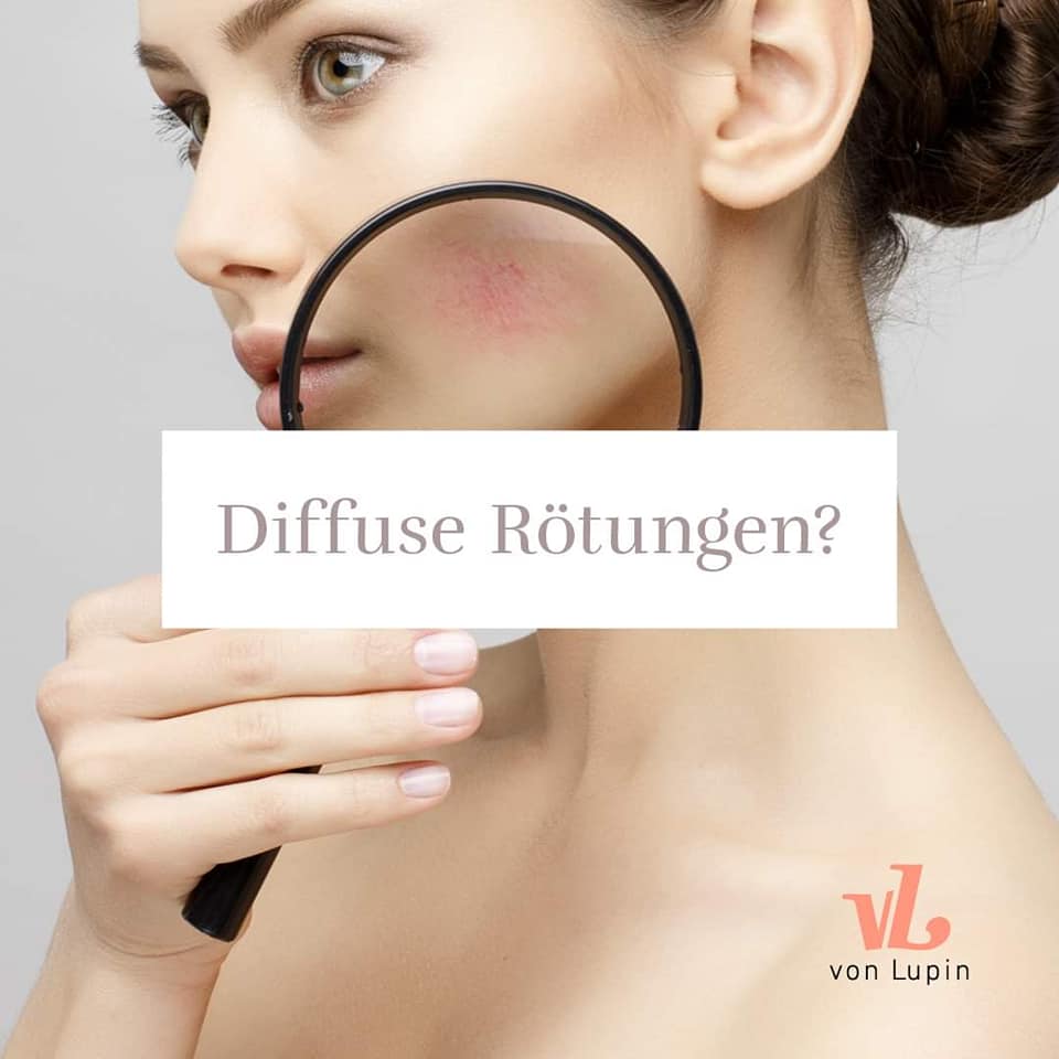 Featured image for “Diffuse Rötungen im Gesicht?”