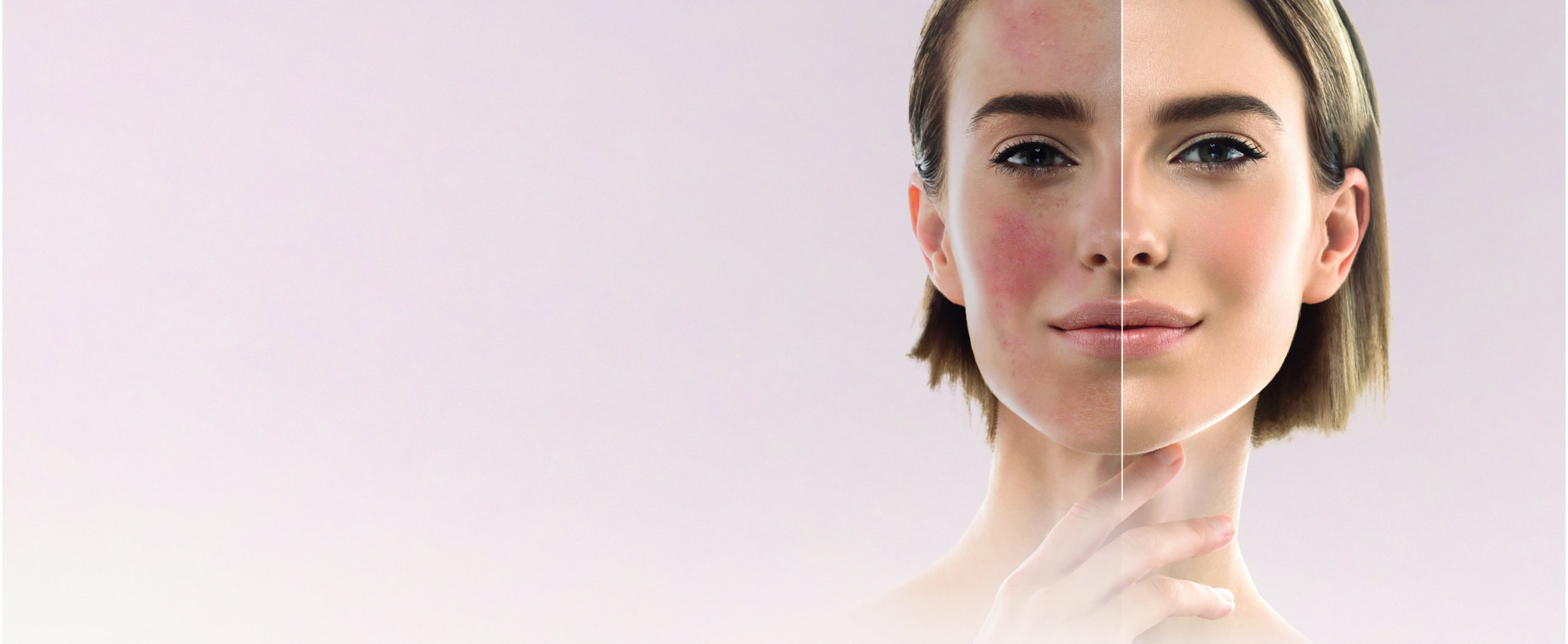 Featured image for “Skin-Coaching”