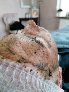 Décaar Algenpeeling